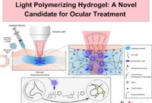 Light Polymerizing Hydrogel