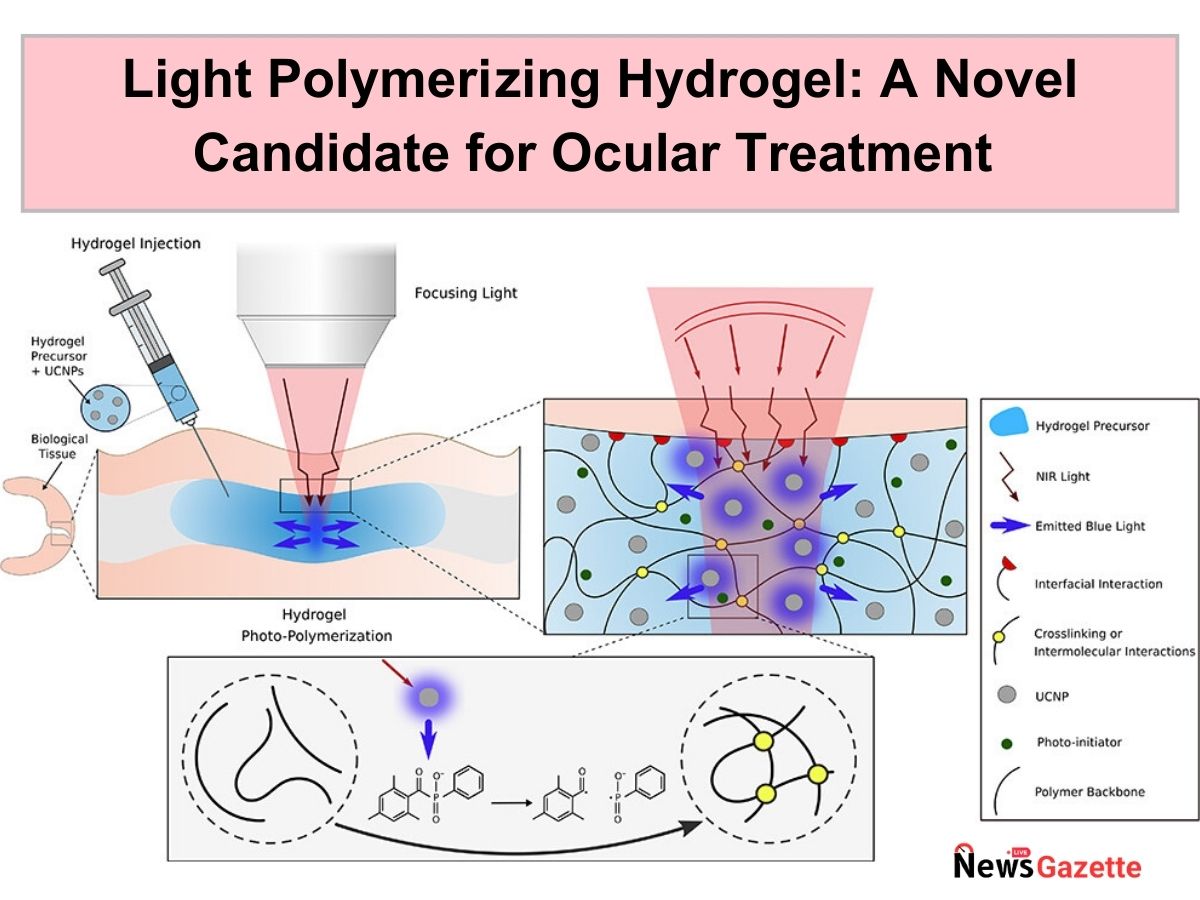 Light Polymerizing Hydrogel