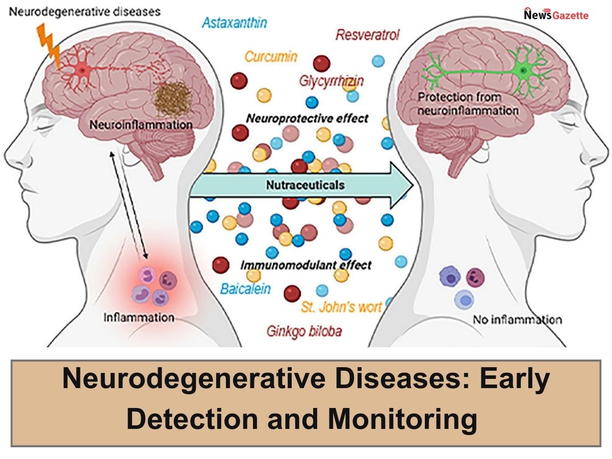 Neurodegenerative Diseases