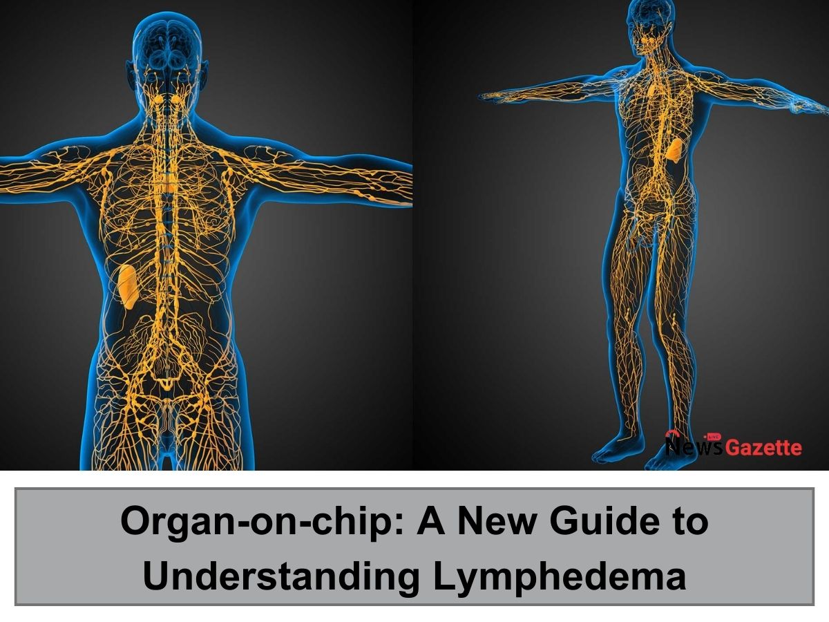 Organ-on-chip